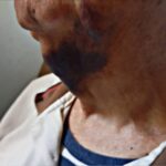 Brutal asalto a un jubilado de 81 años: lo estrangularon hasta dejarlo inconsciente dentro de su casa