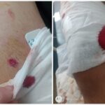 Un menor fue baleado en una pierna al resistirse a un robo